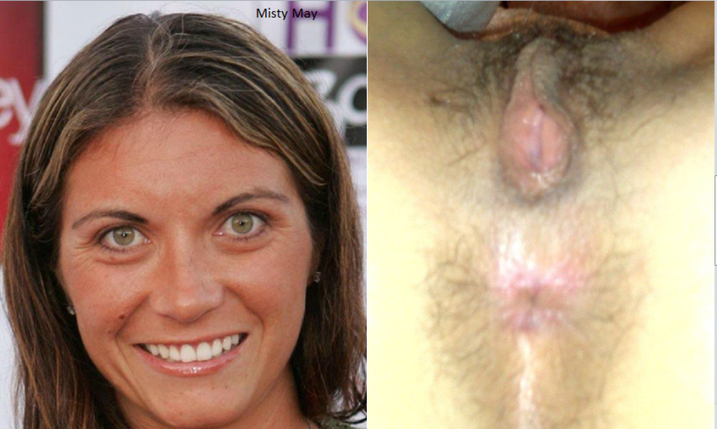 Misty May Treanor Nue Photos Et Vidéos De Misty May Treanor Nue Sex Tapes 