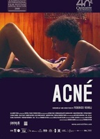 Acné (2008) Scènes de Nu