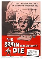 The Brain That Wouldn't Die (1962) Scènes de Nu