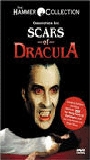 Scars of Dracula (1970) Scènes de Nu